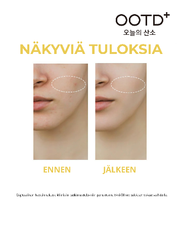 OOTD  Dark Spot Vitamin C Serum 50ml
